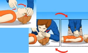 Sơ cứu đuối nước đúng cách – giảm thiểu nguy cơ tử vong