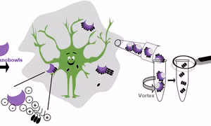 Đột phá công nghệ nano có thể thay đổi biện pháp điều trị bệnh Alzheimer
