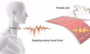 Miếng dán đặc biệt giúp những người rối loạn giọng nói có thể trò chuyện