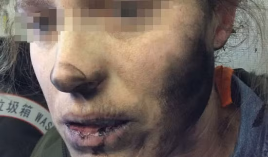 Tai nghe phát nổ trên máy bay khiến hành khách bỏng tay, đen mặt ảnh 2