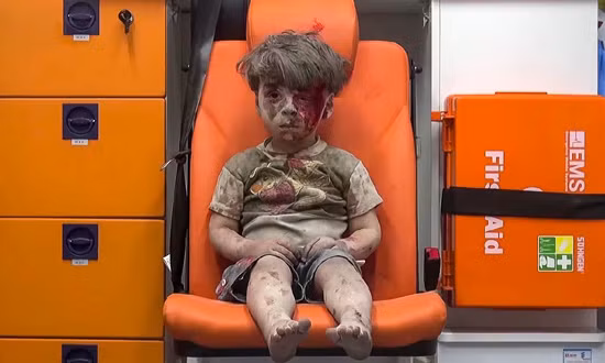 Nhói lòng hình ảnh cậu bé Syria trong xe cứu thương ở Aleppo ảnh 1
