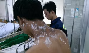 Nổ hoá chất ở chợ "tử thần" Kim Biên, 4 người bị bỏng