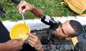 Virus Zika làm tổn thương nghiêm trọng hệ thần kinh