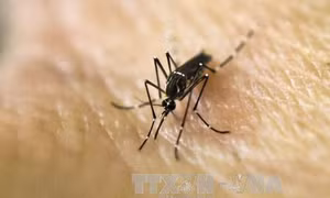 Nguy cơ khiếm thính ở trẻ sơ sinh nhiễm virus Zika 