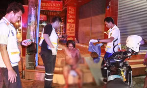 Vợ điên tiết cắt phăng “của quý” chồng vì “léng phéng” với bạn thân