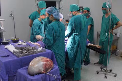 Quảng Ninh: Cắt thành công khối u nang buồng trứng khổng lồ hơn 6kg ảnh 1