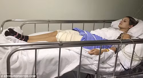Á hậu vòng ba Brazil suýt bị cưa chân vì phẫu thuật thẩm mỹ ảnh 2