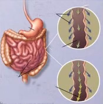Bước tiến mới trong điều trị tiêu chảy ảnh 1