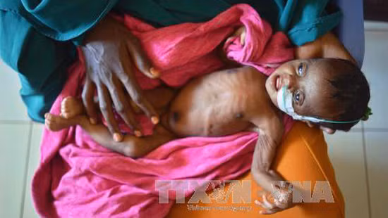 UNICEF: Hơn 1 triệu trẻ em ở CH Trung Phi cần hỗ trợ khẩn cấp ảnh 1