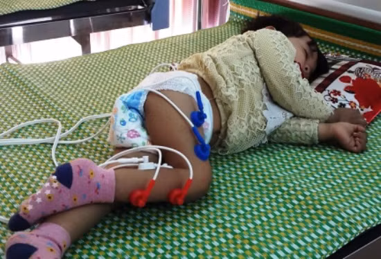 Chuyên gia lên tiếng trước lời kêu cứu trẻ liệt chân vì trị… viêm phổi ảnh 1