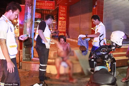 Vợ điên tiết cắt phăng “của quý” chồng vì “léng phéng” với bạn thân ảnh 1