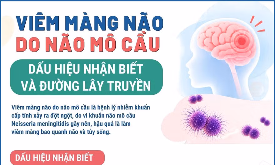 Viêm màng não do não mô cầu: Dấu hiệu nhận biết và đường lây truyền