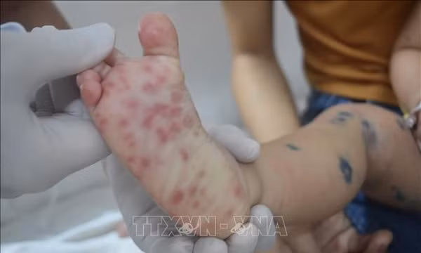 Chủ động dự phòng, ngăn dịch bệnh truyền nhiễm trong cộng đồng