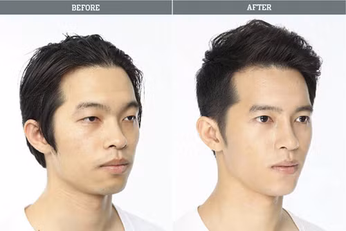 Nhức nhối 'cơn lốc' phẫu thuật thẩm mỹ ở Hàn Quốc ảnh 11