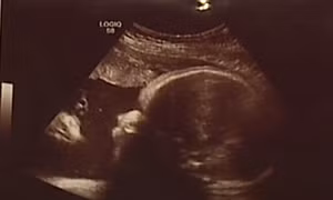 Đi siêu âm, giật mình phát hiện hình ảnh giống 'Chúa Jesus' đang ngắm thai nhi
