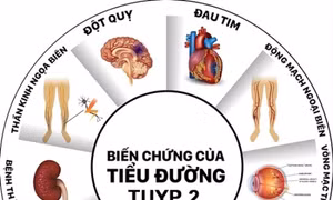 Bụng càng to càng có có nguy cơ mắc đái tháo đường