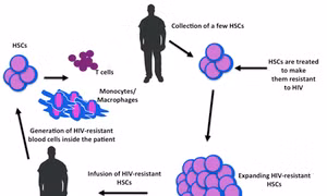 Liệu pháp mới: điều trị HIV/AIDS bằng tế bào gốc của chính bệnh nhân
