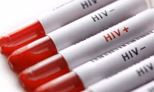 Bắt kẻ trộm chó, một số người có nguy cơ nhiễm HIV