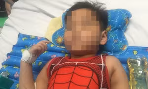 Cứu sống, bảo toàn chân cho bé trai bị ô tô cán nát đùi