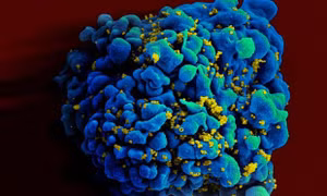 Phát hiện thuốc điều trị ung thư phổi có thể tiêu diệt tế bào nhiễm HIV 
