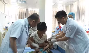 Phẫu thuật miễn phí cho khoảng 150 trẻ sứt môi, hở hàm ếch