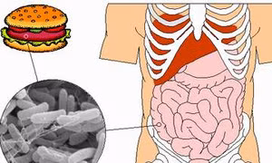 Bộ Y tế khuyến cáo phòng chống bệnh lỵ trực khuẩn