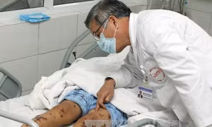 Ghi nhận ca bệnh mắc não mô cầu tại Hà Nội