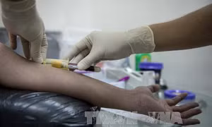 Tiến bộ vượt bậc trong công tác điều trị HIV 