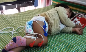 Chuyên gia lên tiếng trước lời kêu cứu trẻ liệt chân vì trị… viêm phổi