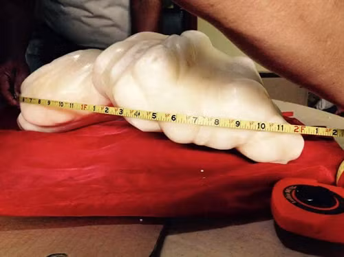 Một ngư dân Philippines tìm thấy khối ngọc trai nặng 34kg