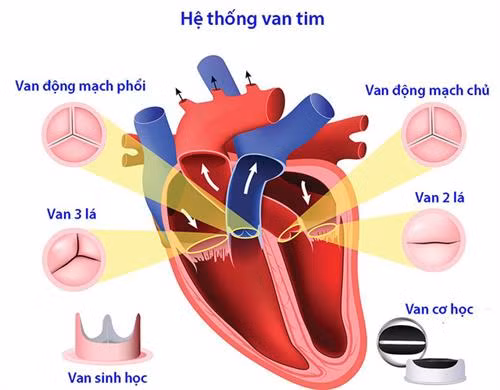 Cứu sống bệnh nhi mắc hội chứng Ehlers-Danlos hiếm gặp