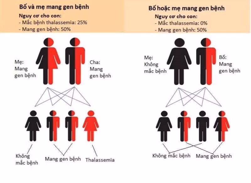 Ngày Thalassemia thế giới (8/5): Bệnh tan máu bẩm sinh dễ phòng nếu chủ động