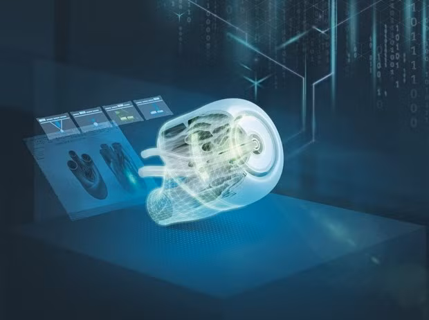 Ảnh minh họa.(Nguồn: Siemens)