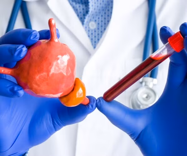 Nghiên cứu của Mỹ nhấn mạnh tầm quan trọng của tầm soát ung thư tuyến tiền liệt