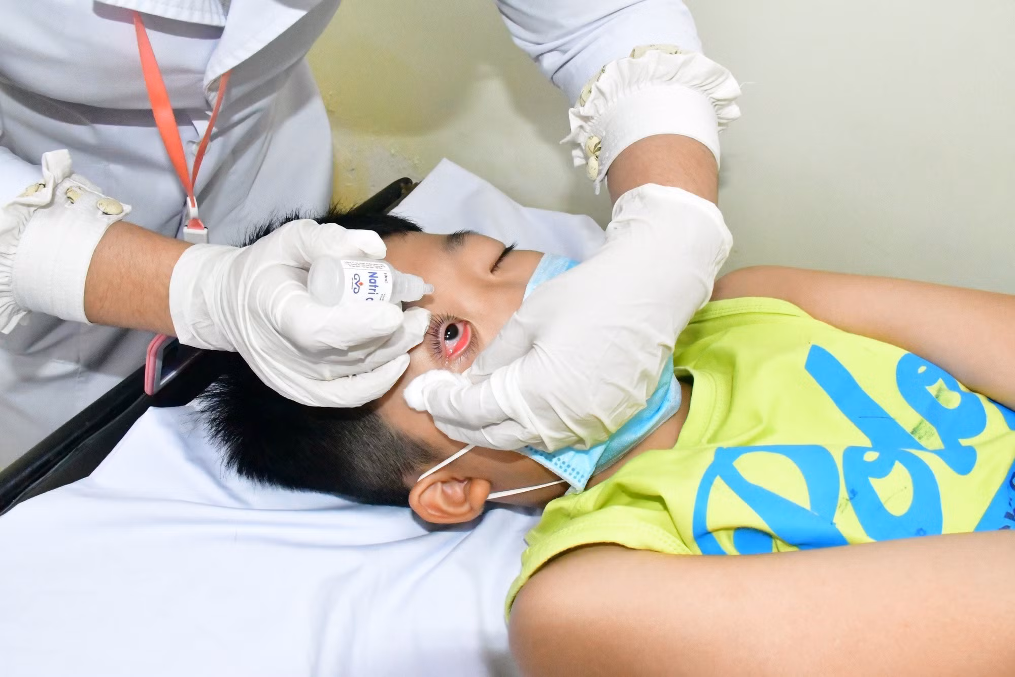 Bạc Liêu: Hạn chế bệnh đau mắt đỏ lây lan trong cộng đồng