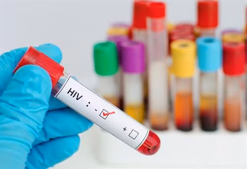 Nam Phi ra mắt thuốc điều trị HIV/AIDS hiệu quả cao