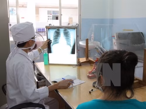 Bước đột phá trong điều trị lao kháng thuốc