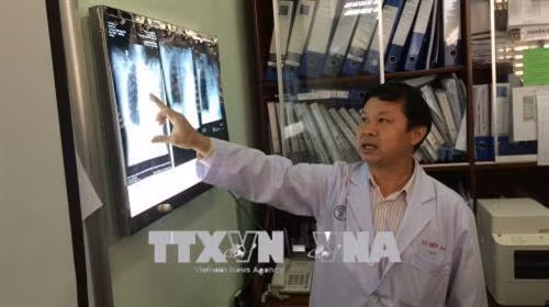 Gắp thành công dị vật đường thở cho bệnh nhân sau 4 lần ngưng thở