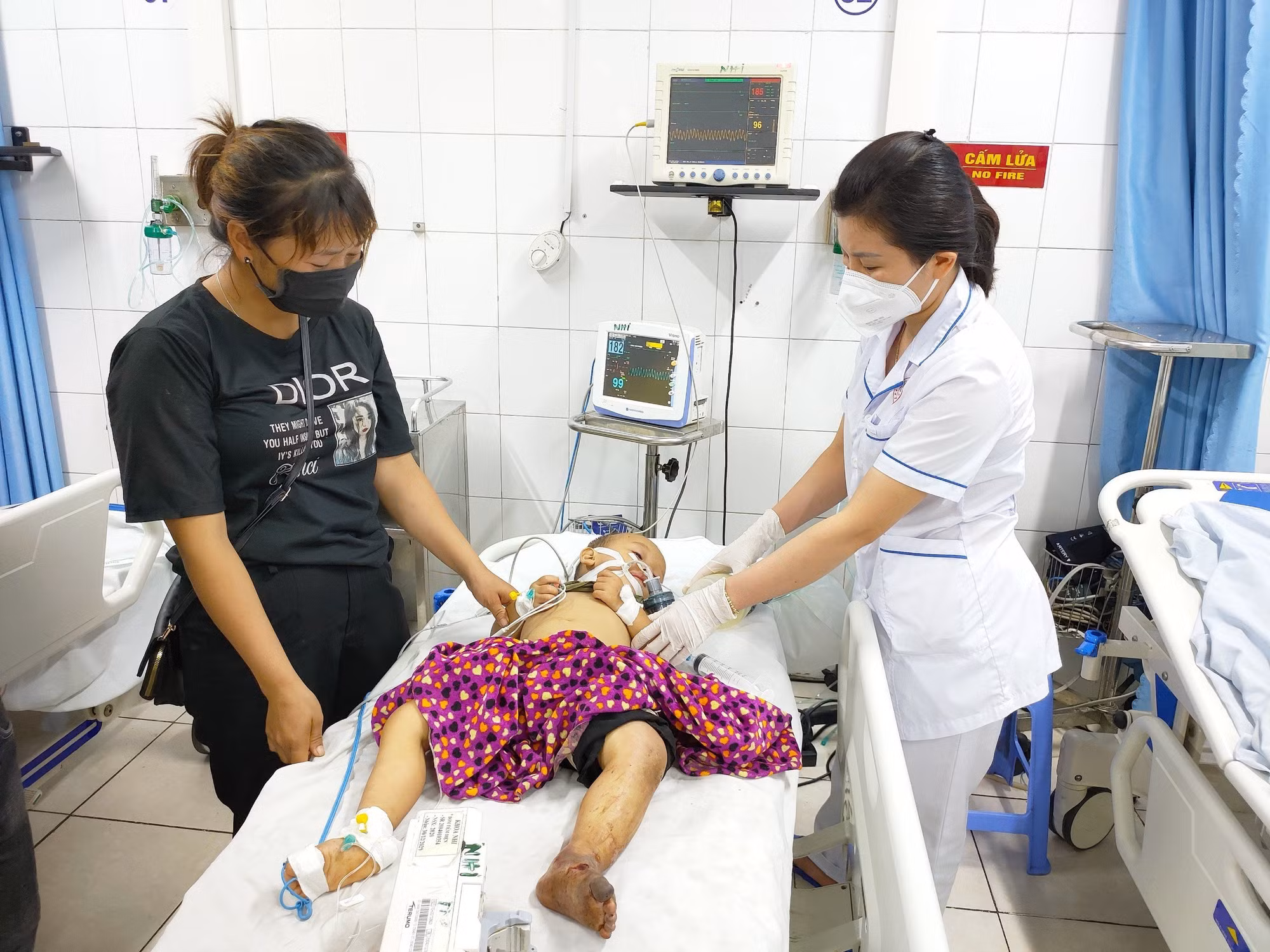Dùng lá cây để chữa rắn cắn khiến bé 2 tuổi nguy kịch ở Tuyên Quang