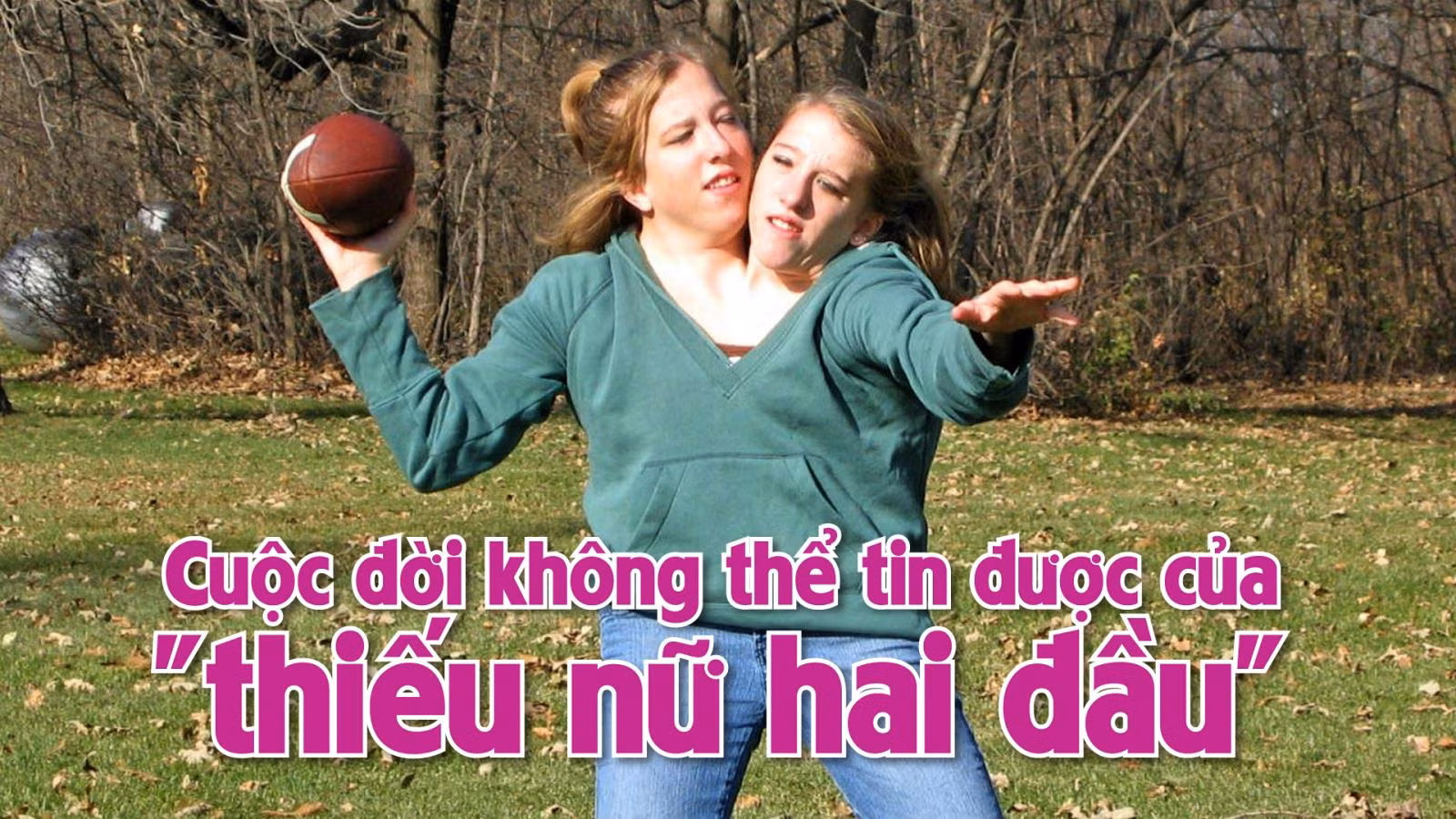 Cuộc đời không thể tin được của 'thiếu nữ hai đầu'