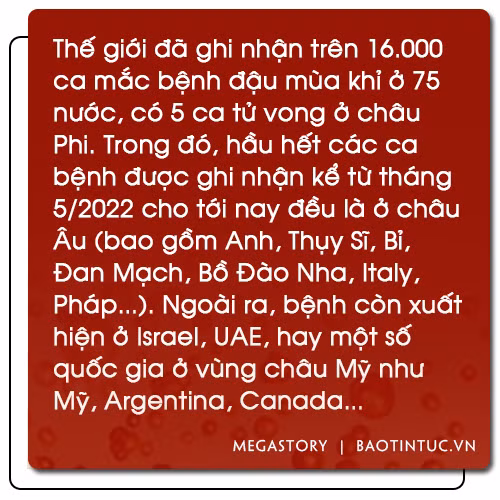 Cảnh giác với bệnh đậu mùa khỉ ảnh 4