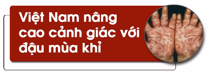 Cảnh giác với bệnh đậu mùa khỉ ảnh 13