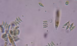 Phát hiện virus gây nhiễm độc làm trí tuệ sa sút