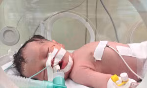‘Phép màu’ cũng chết ở Gaza