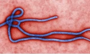 5 vi rút đáng sợ hơn Ebola 