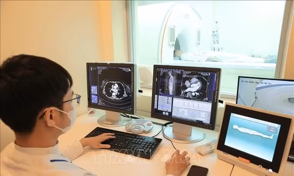 Chụp CT vùng ngực hé lộ nguy cơ suy giảm nhận thức sớm