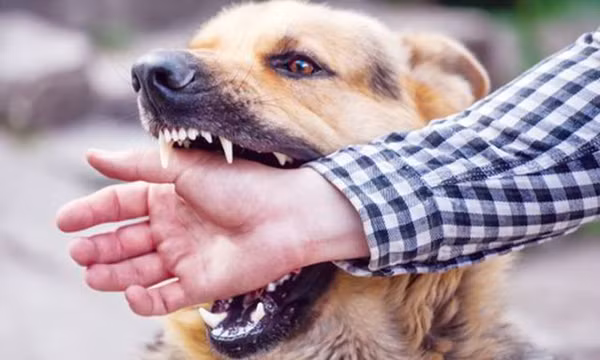 Chó tấn công nhiều người ở Quảng Ngãi dương tính với virus dại