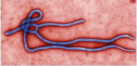 5 vi rút đáng sợ hơn Ebola ảnh 1