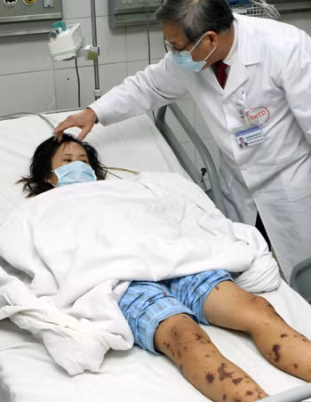 Ca viêm não mô cầu đầu tiên ở miền Bắc ảnh 2