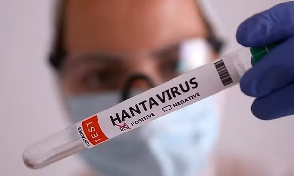 Gia tăng ca tử vong do virus Hanta, Chile ban bố cảnh báo y tế 